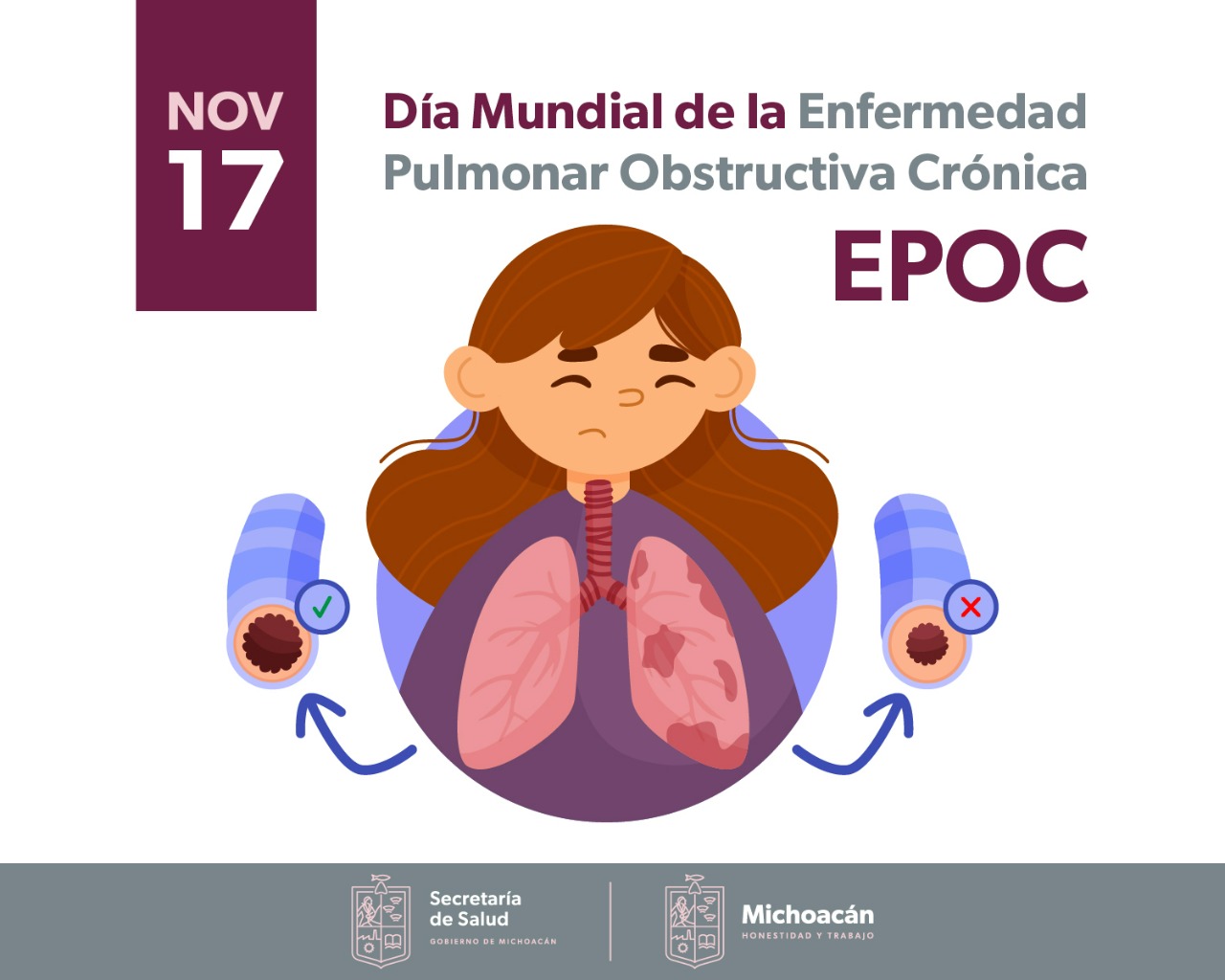 SALUD | Tabaquismo, Principal Factor De Riesgo Para Desarrollar EPOC: SSM