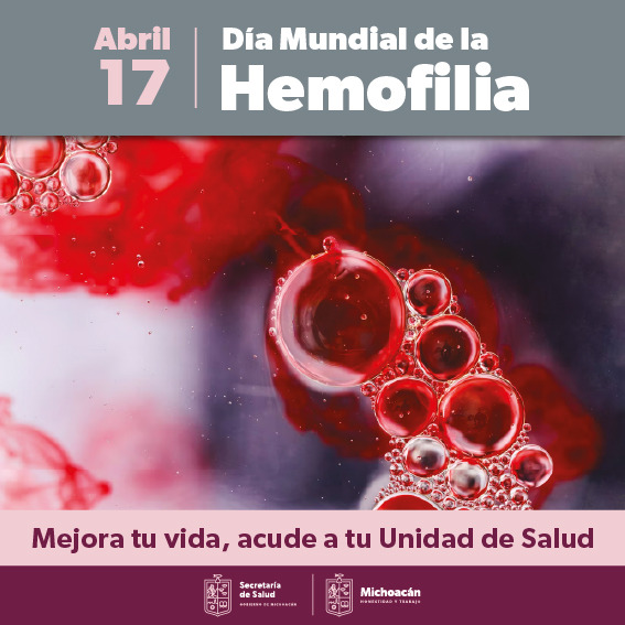 Salud Ofrece Ssm Tratamiento Innovador Y Gratuito A Pacientes Con Hemofilia 9845