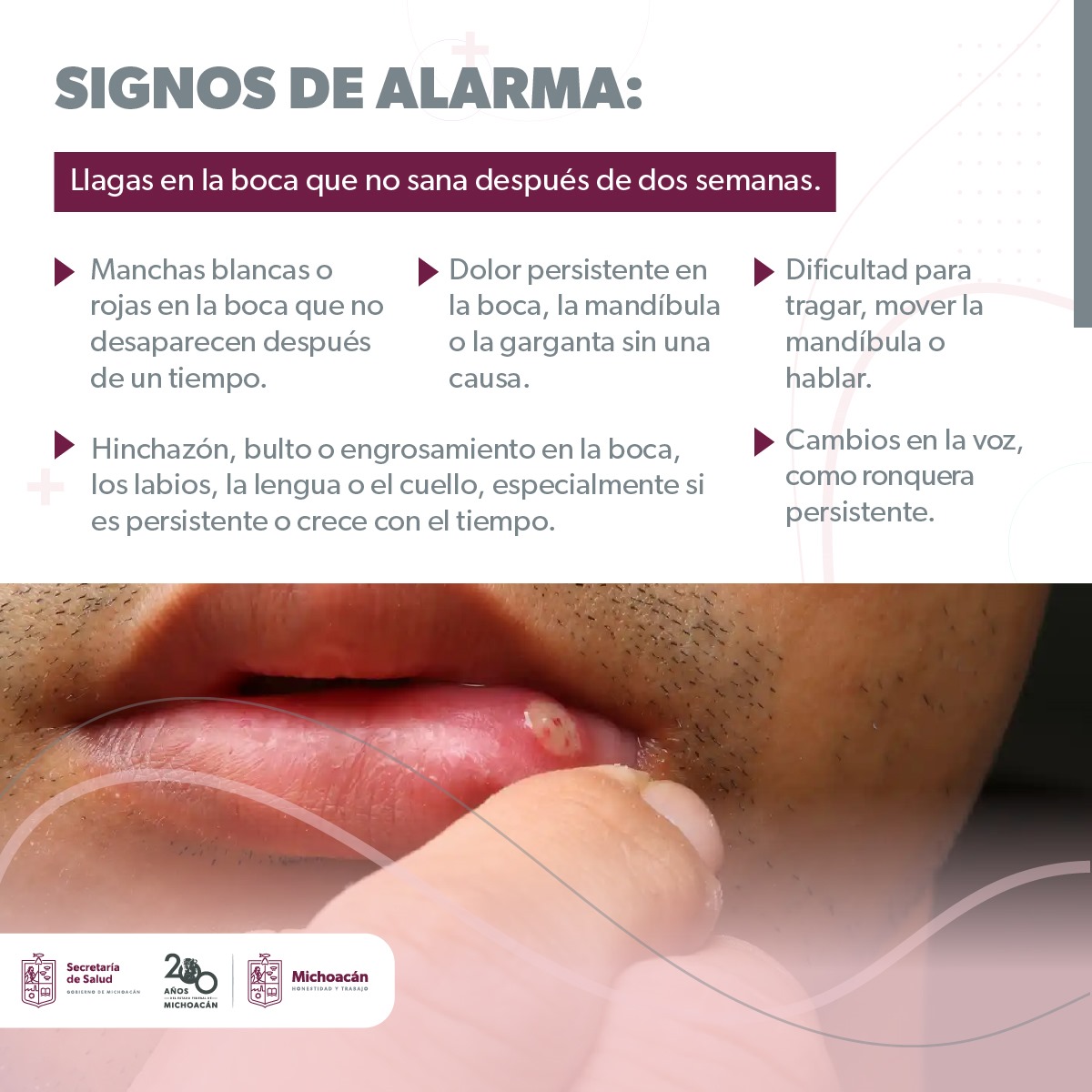 SALUD | Estos hábitos te pueden provocar cáncer de boca y lengua